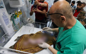 Bebelușul care fusese salvat din pântecele mamei decedate în Gaza a murit la spital. Nici tatăl, nici sora nu mai sunt în viață